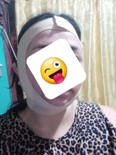 Vendaje adelgazante Facial para adelgazar, forma de correa para estiramiento, Reduce el doble mentón y rostro, masaje de banda para adelgazar, gran oferta