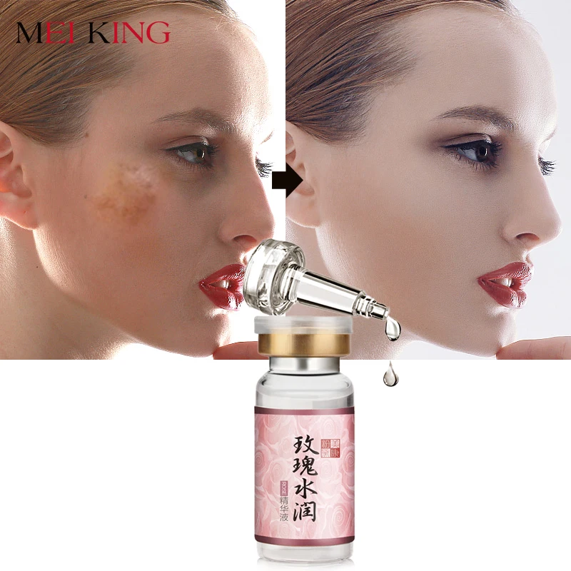 MEIKING Face Serum Rose Moistening Essence Whitening Cream Remove Acne Anti Wrinkle For Face Skin Care Blemish Facial Cream
MEIKING Face Serum Rose Moistening Essence Whitening Cream Remove Acne Anti Wrinkle For Face Skin Care Blemish Facial Cream