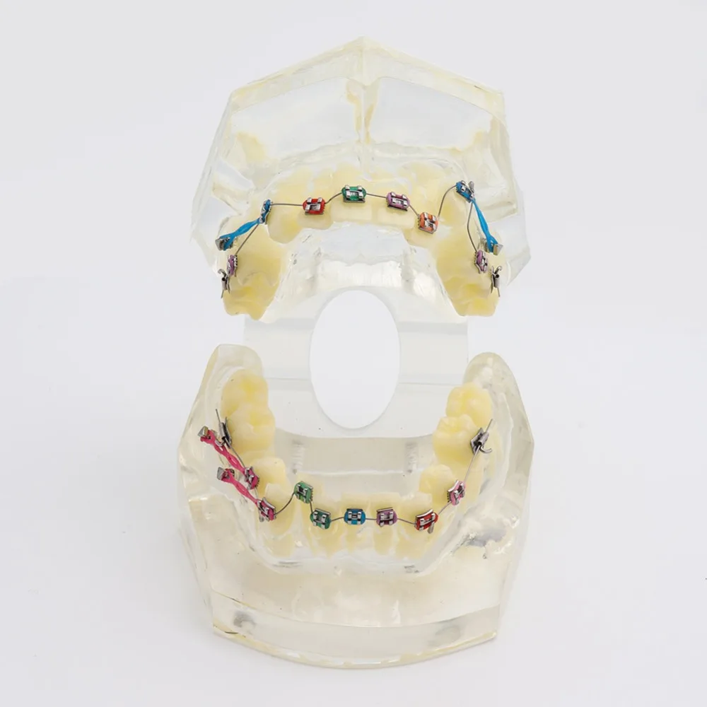 Стоматологическая стандартная Ортодонтическая модель зубов с кронштейнами и
