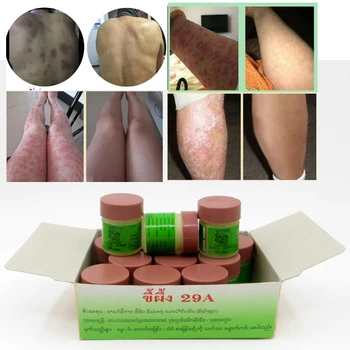24PCS Chinese Ointment Psoriasi Eczma Cream Works Perfect For All Kinds Of Skin Problems Patch
24PCS Chinese Ointment Psoriasi Eczma Cream Works Perfect For All Kinds Of Skin Problems Patch