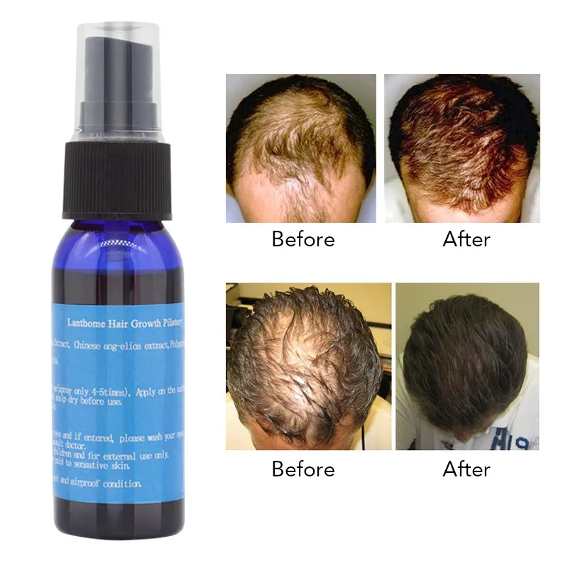 Hair Care Fast Hair Growth Essential Oil Chinese Herbal Ginger Liquid Anti Hair Loss Dandruff Treatment Pilatory Sprayer 30ml
Hair Care Fast Hair Growth Essential Oil Chinese Herbal Ginger Liquid Anti Hair Loss Dandruff Treatment Pilatory Sprayer 30ml