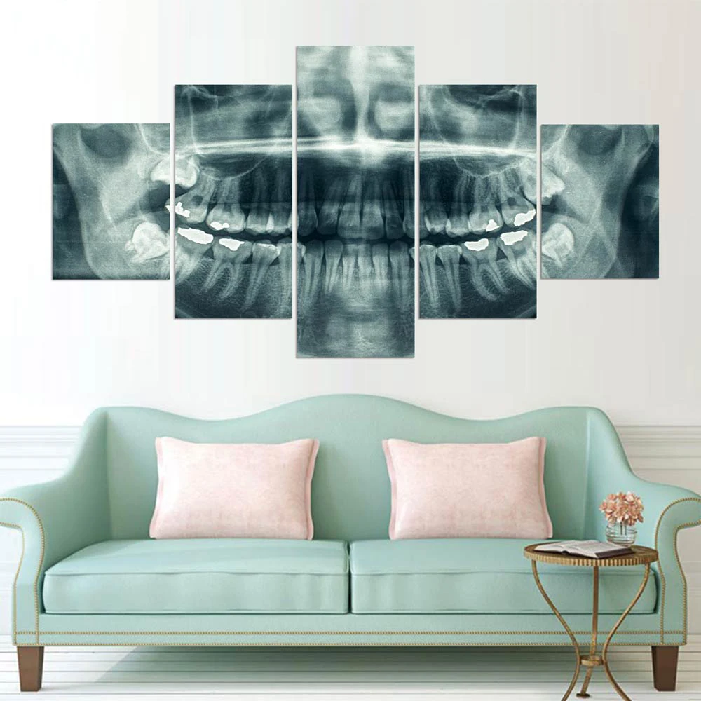 Modular Pictures Wall Art Home Decoration 5 Piece Dental X-Ray Posters Frame Living Room HD Printed Modern Painting On Canvas
Modular Pictures Wall Art Home Decoration 5 Piece Dental X-Ray Posters Frame Living Room HD Printed Modern Painting On Canvas