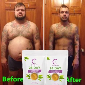 Fat Burn 28 Day Detox Tea Detox Reduce Bloating And Constipation Weight Loss Body Cleanse For Women And Men
Fat Burn 28 Day Detox Tea Detox Reduce Bloating And Constipation Weight Loss Body Cleanse For Women And Men