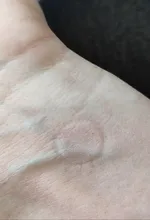 Removedor profundo espinilla profesional, limpieza de poros, vacío, belleza Facial, cuidado de la piel, herramientas