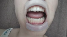 1PC odontología O forma de higiene Oral dentista blanqueador de dientes Intraoral Retractor de labios y mejillas boca abridor ortesis