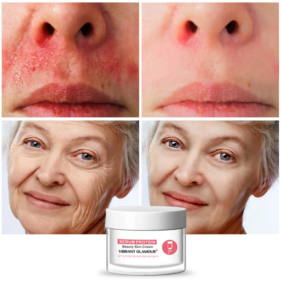 Skin Care Serum Protein Face Cream Repair Anti-Wrinkle Reduce Red Blood Anti-allergy Deep Hydration Moisturizing
Skin Care Serum Protein Face Cream Repair Anti-Wrinkle Reduce Red Blood Anti-allergy Deep Hydration Moisturizing