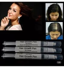 Minoxidil-aceite para el crecimiento del cabello, tratamiento tónico para el cabello, productos para el cuidado de la pérdida del cabello, 5%