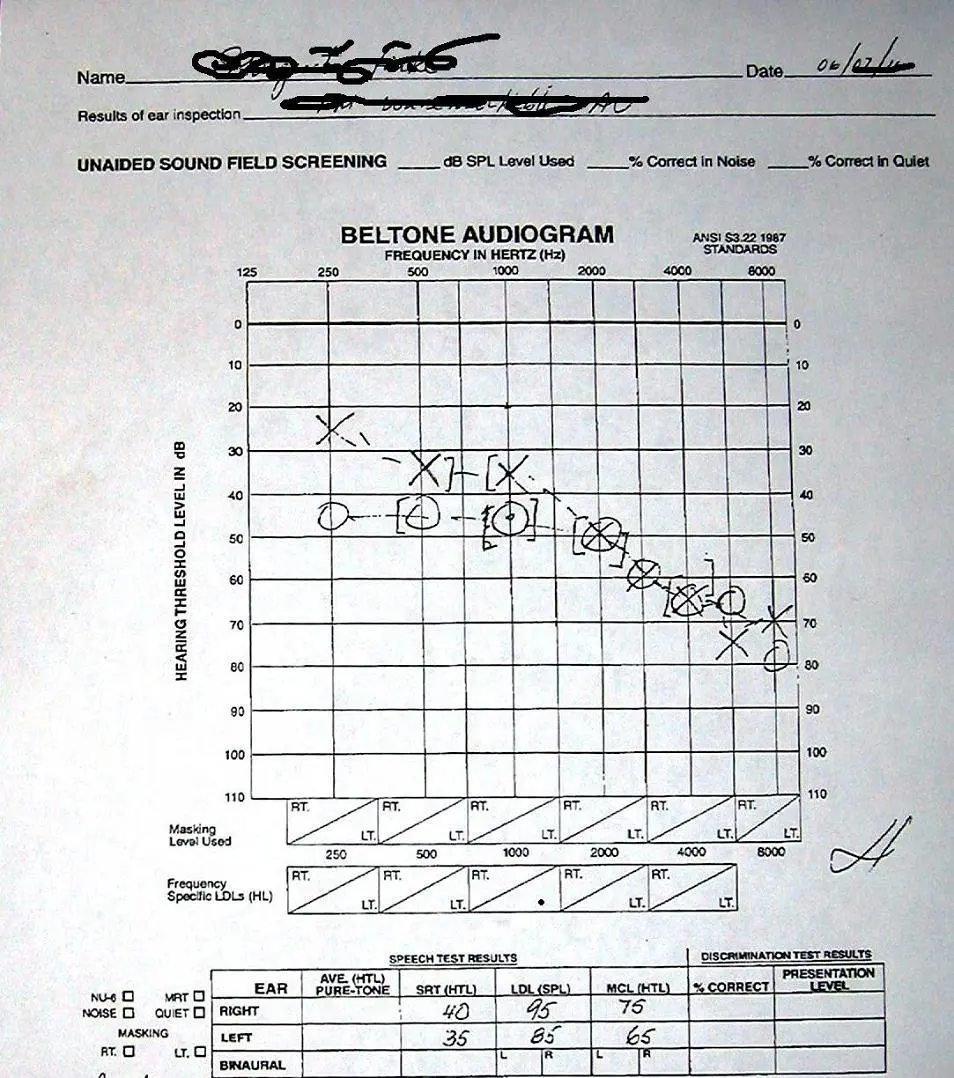 audiogram report hearing aid.JPG