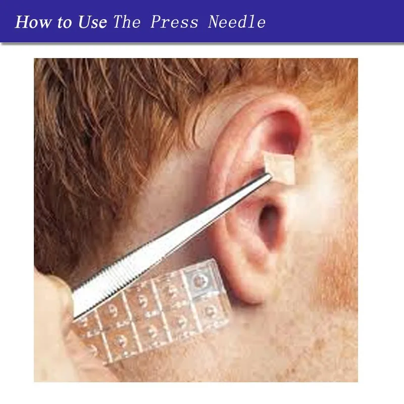 acupuncture press needles2
