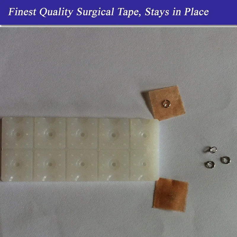 acupuncture press needles1