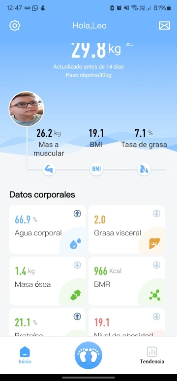 ⚖️ סולם דיגיטלי חכם למשקל גוף! 📊 מדוד גוף גוף, איזון גוף ו-Bioimpedance עם משקל עד 180 ק"ג. מושלם למעקב בריאות מקצועי למבוגרים!