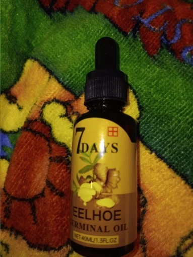 Ginger Hair Care Oil Hair Roots Scalp Treatment Improve Androgenetic Alopecia Scalp Treatment Serum Strengthen Hair Roots photo review