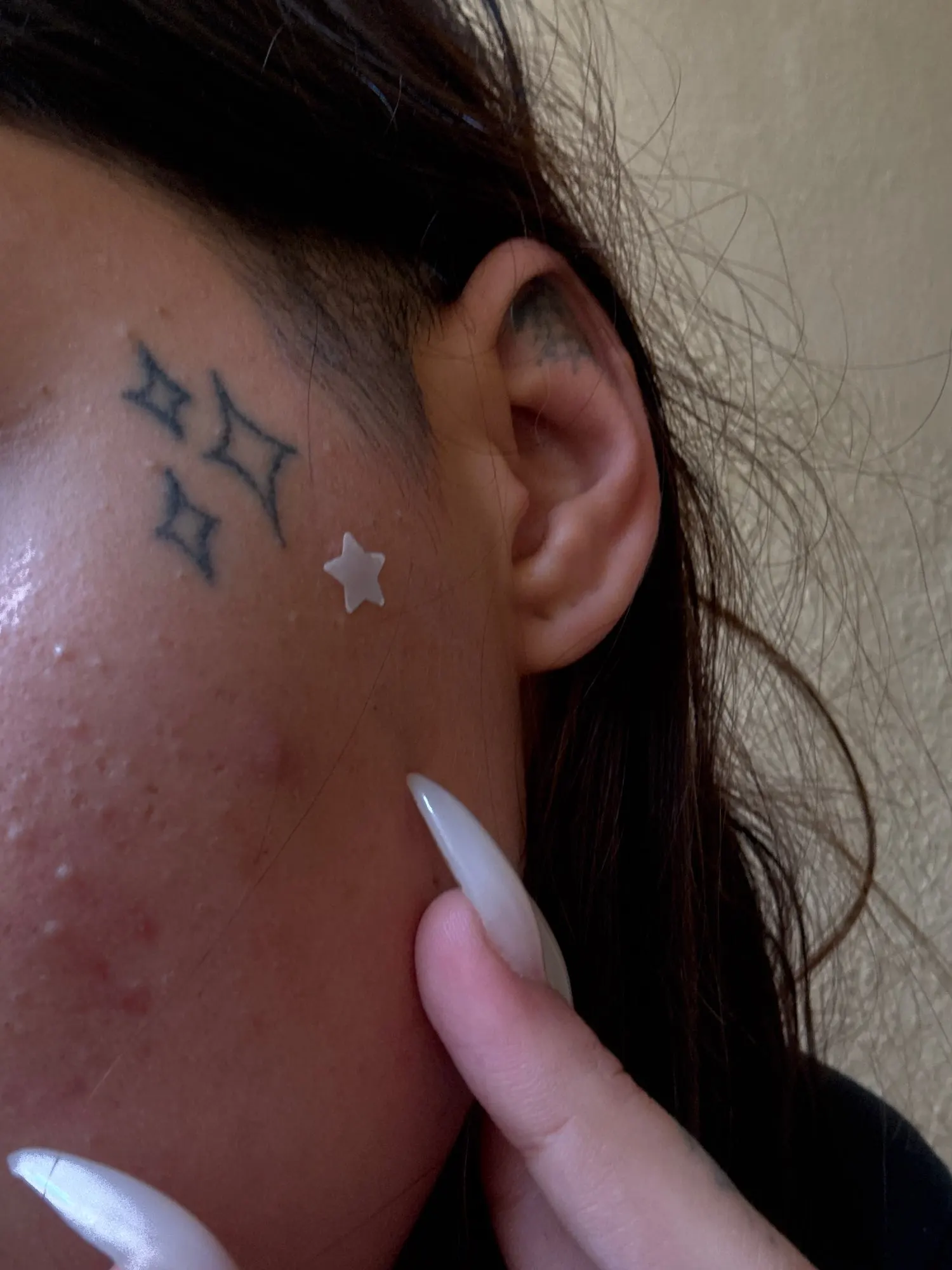 240 Uds nuevo parche para espinillas parches para acné corazón/estrella/flor/forma redonda parches de puntos para acné hidrata para cubrir manchas y imperfecciones photo review