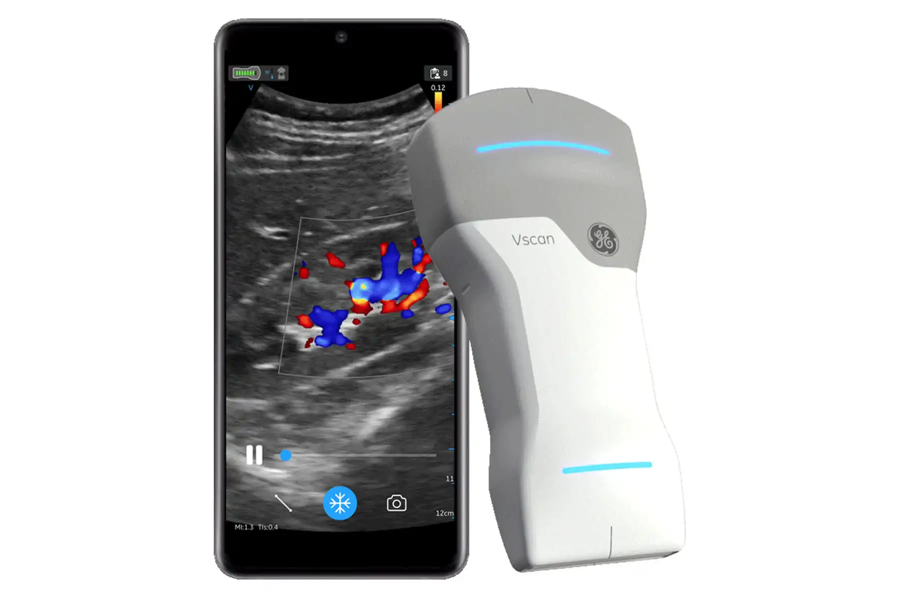 New Release V scans Air CL Handheld GE Ultra-sounds System