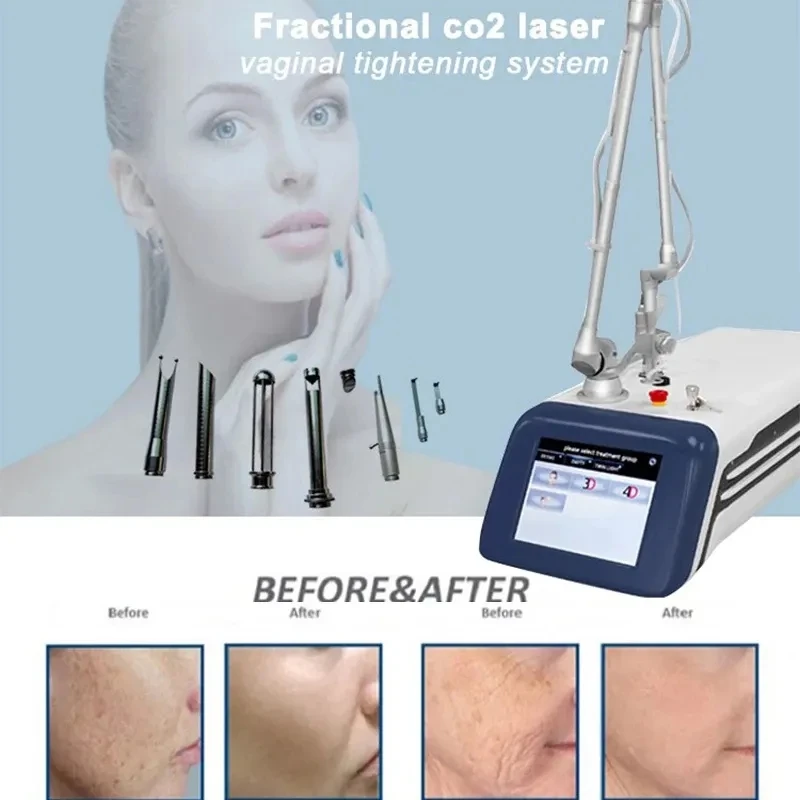 

Factory sells a portable model of the best skin stretch marks removal 10600nm 4D co2 fractional laser vaginal tightening machine