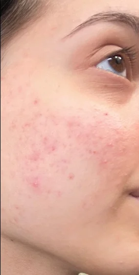 day-whitening-cream-