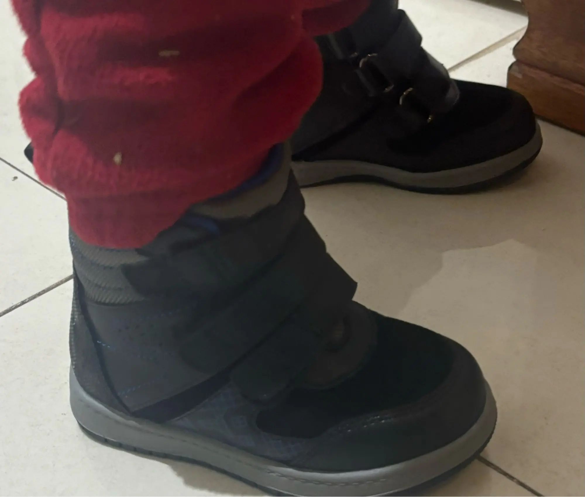 Princepard Ankle Boots for Girls Boys Orthopedic Children's Sneakers with Arch Support Insoles Pink Grey Leather Kids Shoes photo review