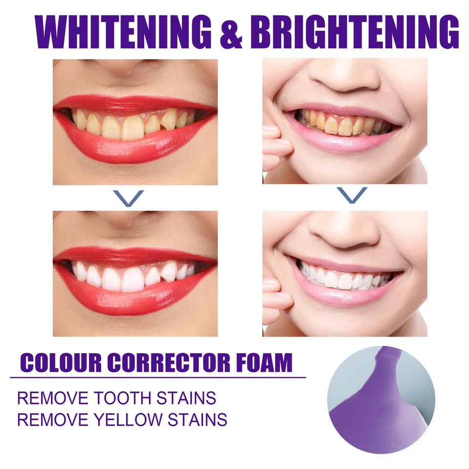 Brightening Teeth Whitening Toothpaste for Fresh Breath