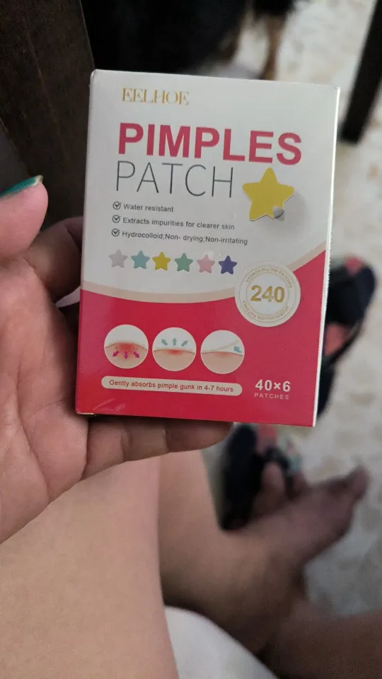240 Uds nuevo parche para espinillas parches para acné corazón/estrella/flor/forma redonda parches de puntos para acné hidrata para cubrir manchas y imperfecciones photo review