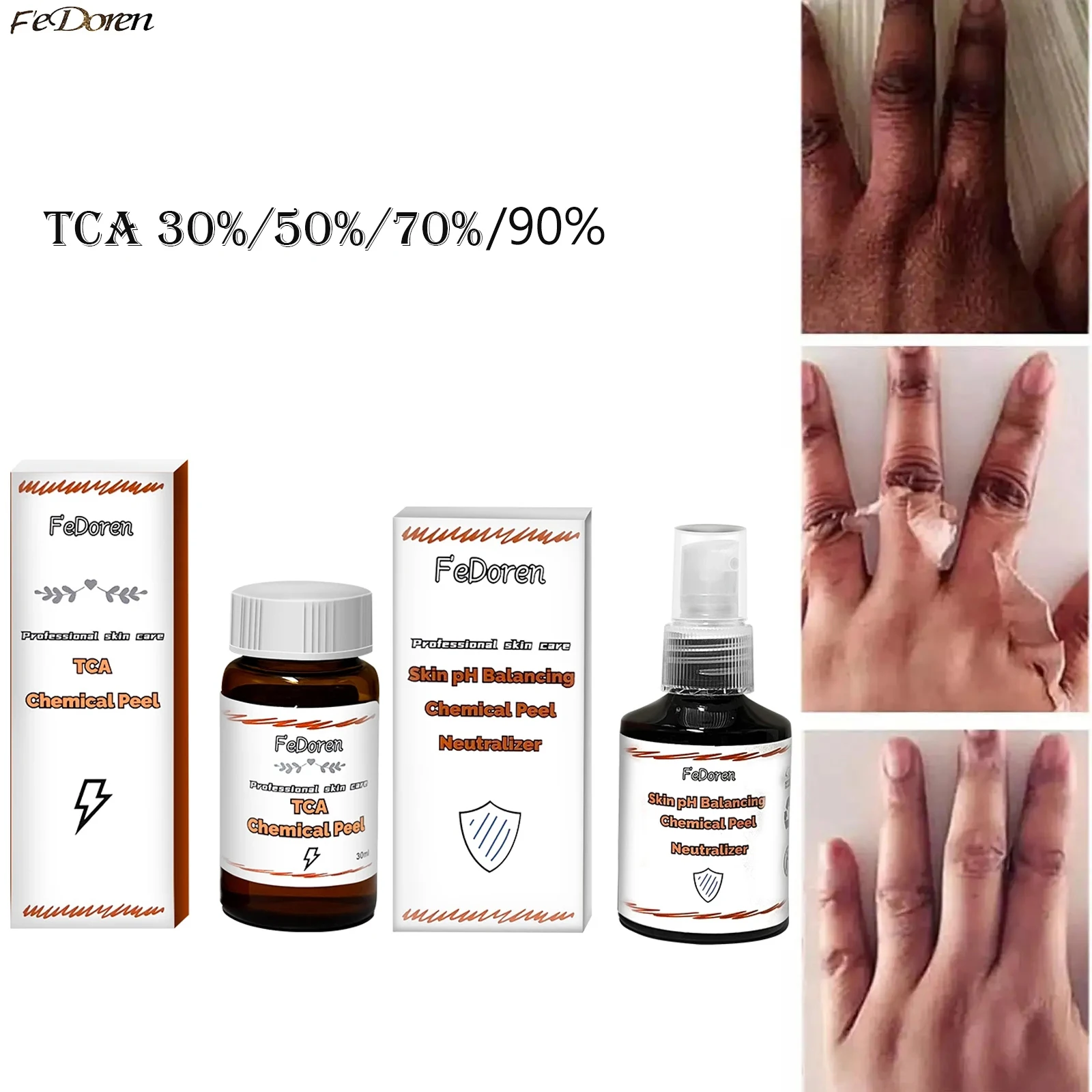30ml High Power Skin Peeling 50% 20% TCA For Dark Skin Soften Body chemical Peel Off Dead Skin Moisturizing Exfoliator