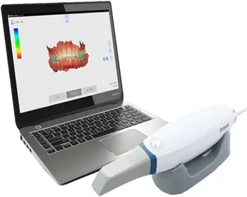 OFFERTA PROMOZIONALE Scanner Intraorale QuickScan iOS, Scanner per Impronte 3D, per Lavori Dentali e Ortodontici
