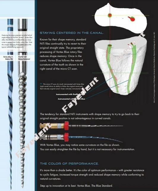 Dentsply Tulsa Dental Vortex Blue Rotary Files - 21, 25, 30mm Taper, 30 Files Per Pack (Swiss Made) 3 thumbnail image