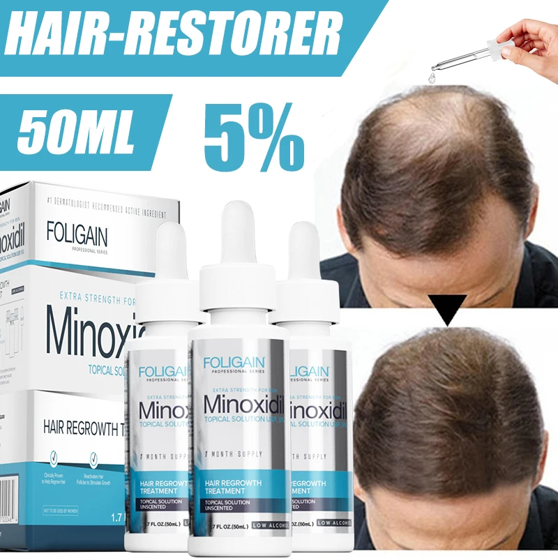 Re:ACT Minoxi Roll-On Hair Treatment, Natural Nourishing Hair Scalp Oil For  Women Men, Hair Growth Serum For Thinning Hair And Hair Loss, Anti Frizz |  