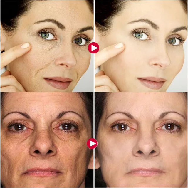 Crème Anti-rides instantanée pour le visage, produit de soins pour la peau, raffermissant, Anti-âge, estompe les ridules, hydratant, éclaircissant, beauté pour femmes