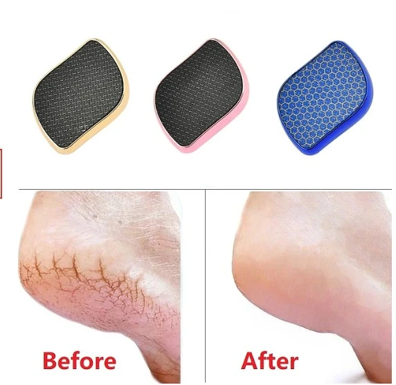 Glass Foot File Callus Remover - Foot Scrubber Heel Scraper for Dead Skin  Remova