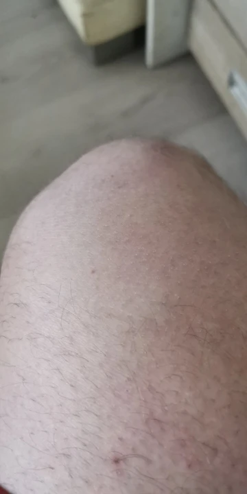 Crystal Hair Remover photo review