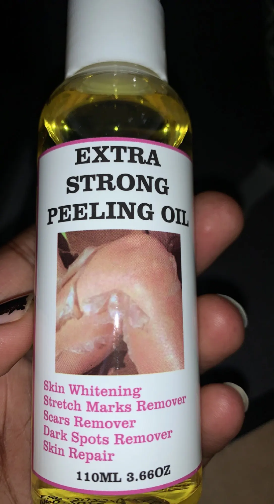 Gul Peeling Oil Blekning Mörka hudfläckar Pormaskar Fläckar Dåliga hudfläckar Behandling Extra Stark Whitening Peeling Oil photo review