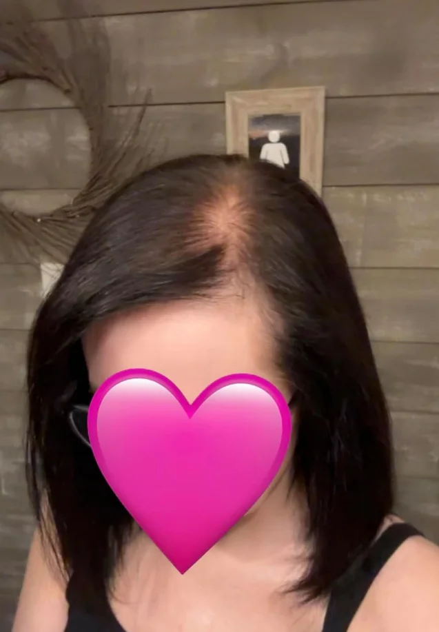 Prisegami kirpčiukai, natūralių plaukų photo review