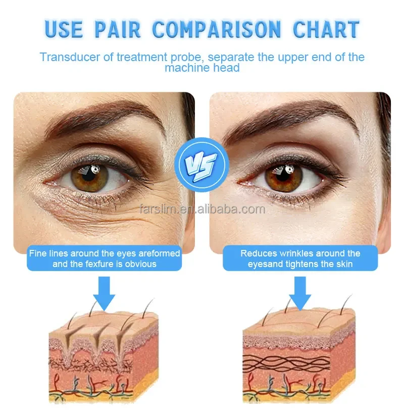 Description Picture 6 of item3 in 1 Remove wrinkles machine skin care With ice hammer