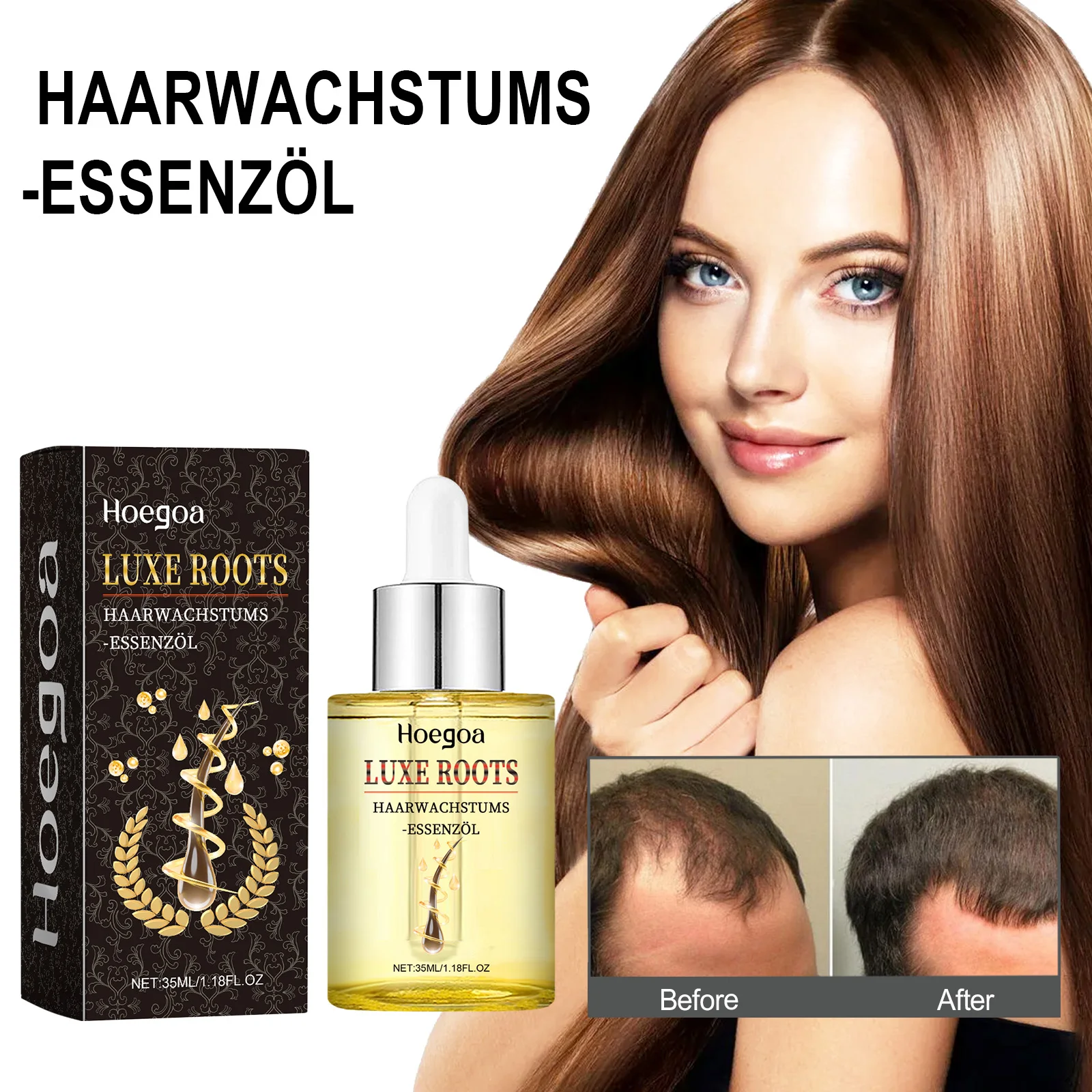 Luxe Roots Haarwachstums -Essenzol Hair Growth Scalp Massage Treatment Moisturizing Supple Plump Dense Hair Care Essential Oil