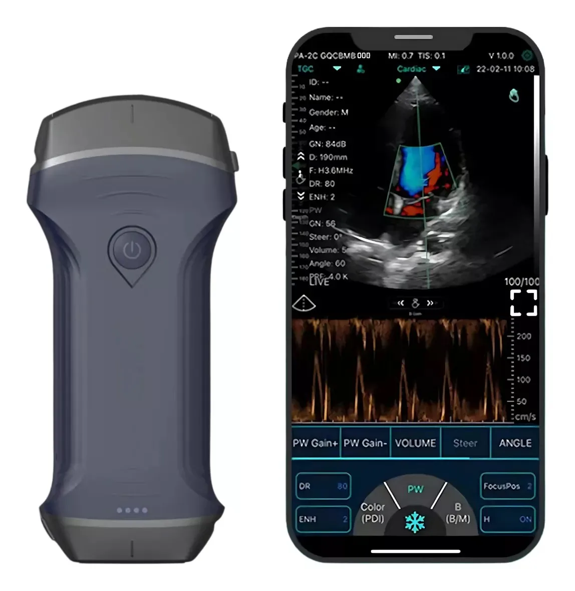 DISCOUNTED Portable Ultrasound Pro 3 In 1 Convex + Linear + Cardiac
