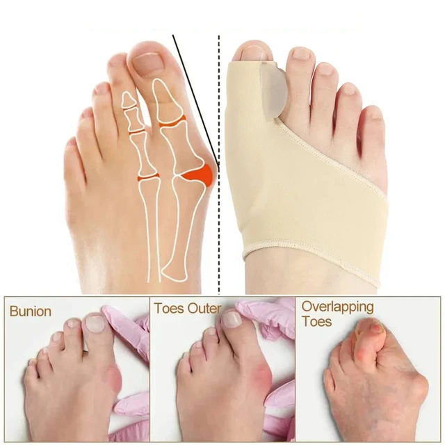 2Pcs=1Pair Big Toe Separator Hallux Valgus Pain Relief Bunion Corrector  Women Men Soft Gel Toe Straightener Orthotics Foot Care - AliExpress
