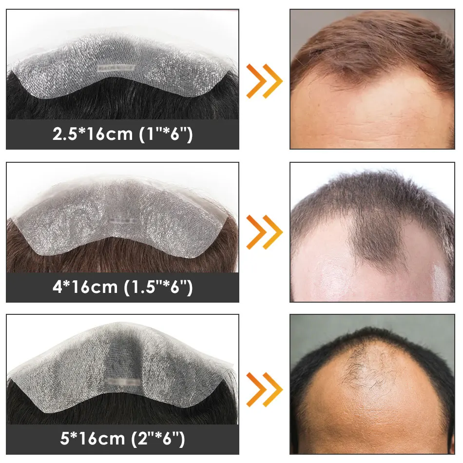 Front Men Toupee Mens Wig Natural PU Hairline Human Hair Piece Thin Skin Remy Hair System Unit Prosthesis Patch Free Shipping