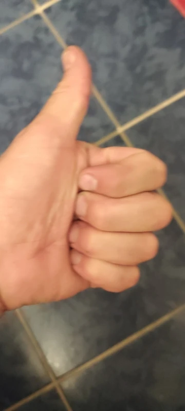 YUTOKO 1pcs Hinge Stainless Steel Door Hydraulic Hinges Damper Buffer Soft Close For Cabinet Door Cupboard Furniture Hardware photo review