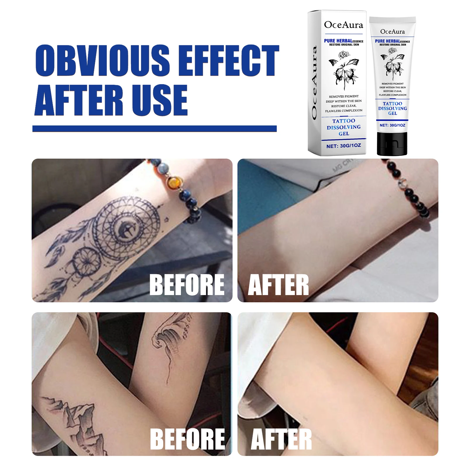 Oceaura Herbal Tattoo Remove Gel 4