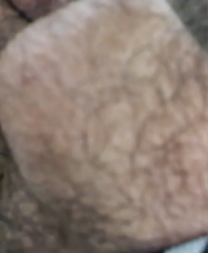 Eelhoe - Das Serum für schnelles Haarwachstum und gesunde Kopfhaut photo review