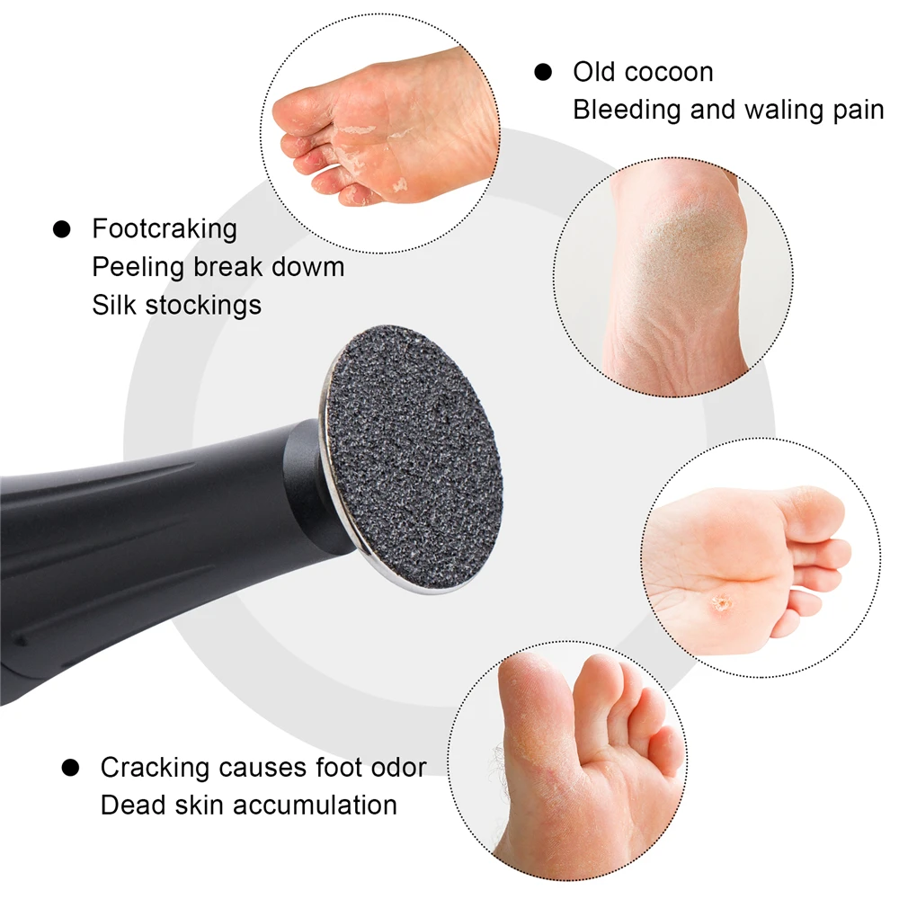 50-Piece Sandpaper Disc Set for Pedicure and Exfoliation