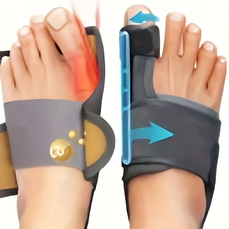 Tech Love Bunion Corrector For Women Men Big Toe 1 Pair, Adjustable Bunion Splint With 2 Angle Bar, Pads