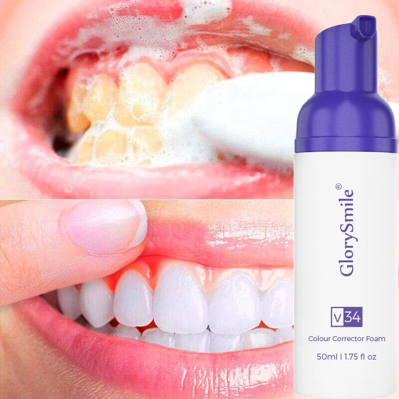 Glorysmile 50ml V34 Colour Corrector Purple Tooth Stain Removal Teeth
