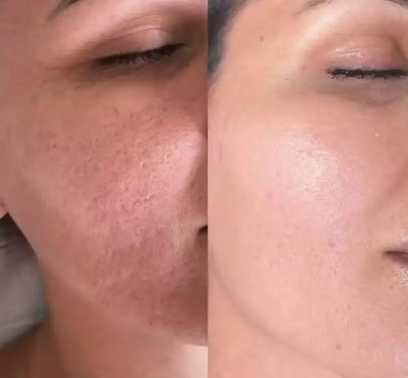 Serum Hidratación Profunda Ácido Hialurónico