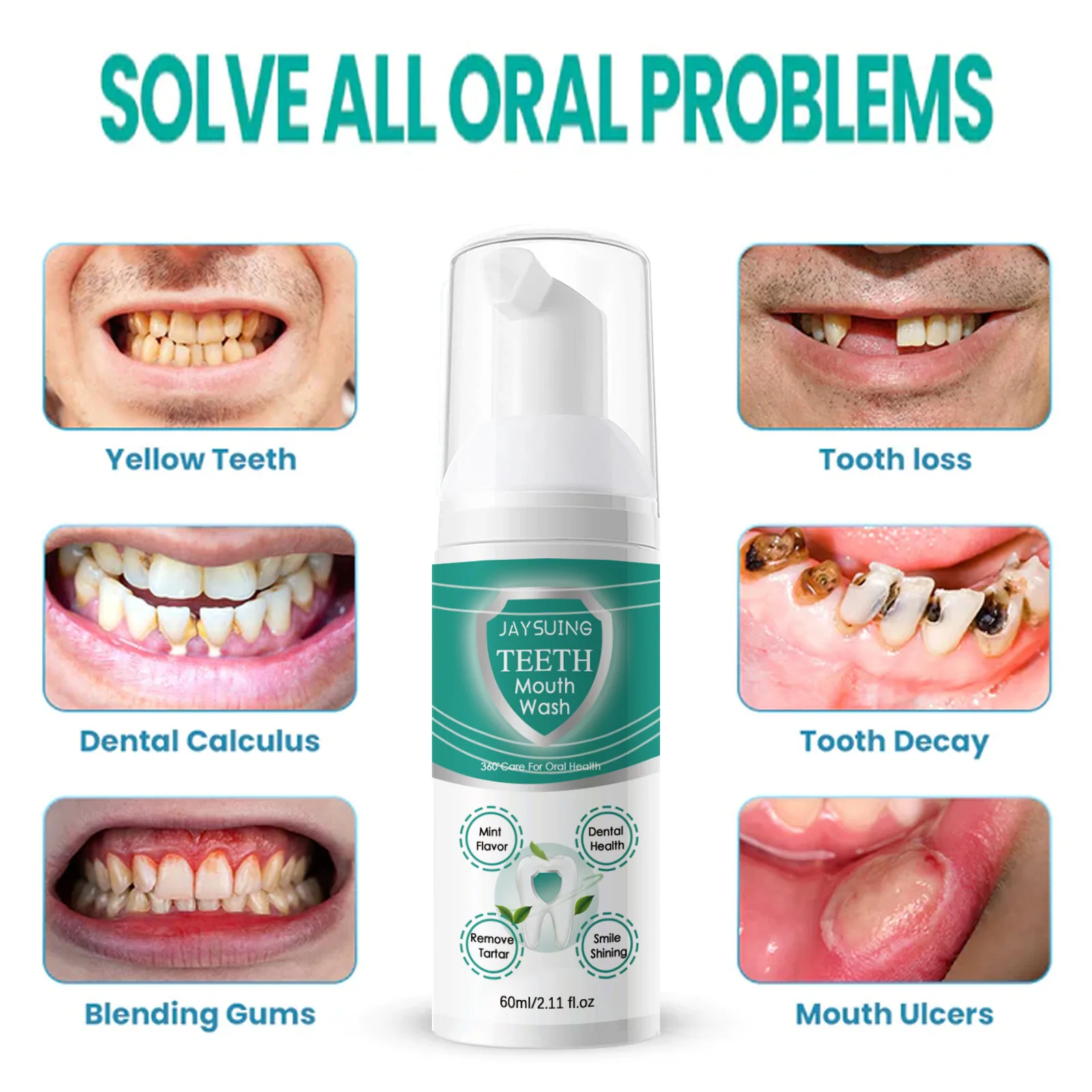 Yellow Teeth Cleaning Mousse Oral Care Whitening Remove Plaque Repair Caries Gums Clean Dental Stains Freshen Breath Foam Mousse