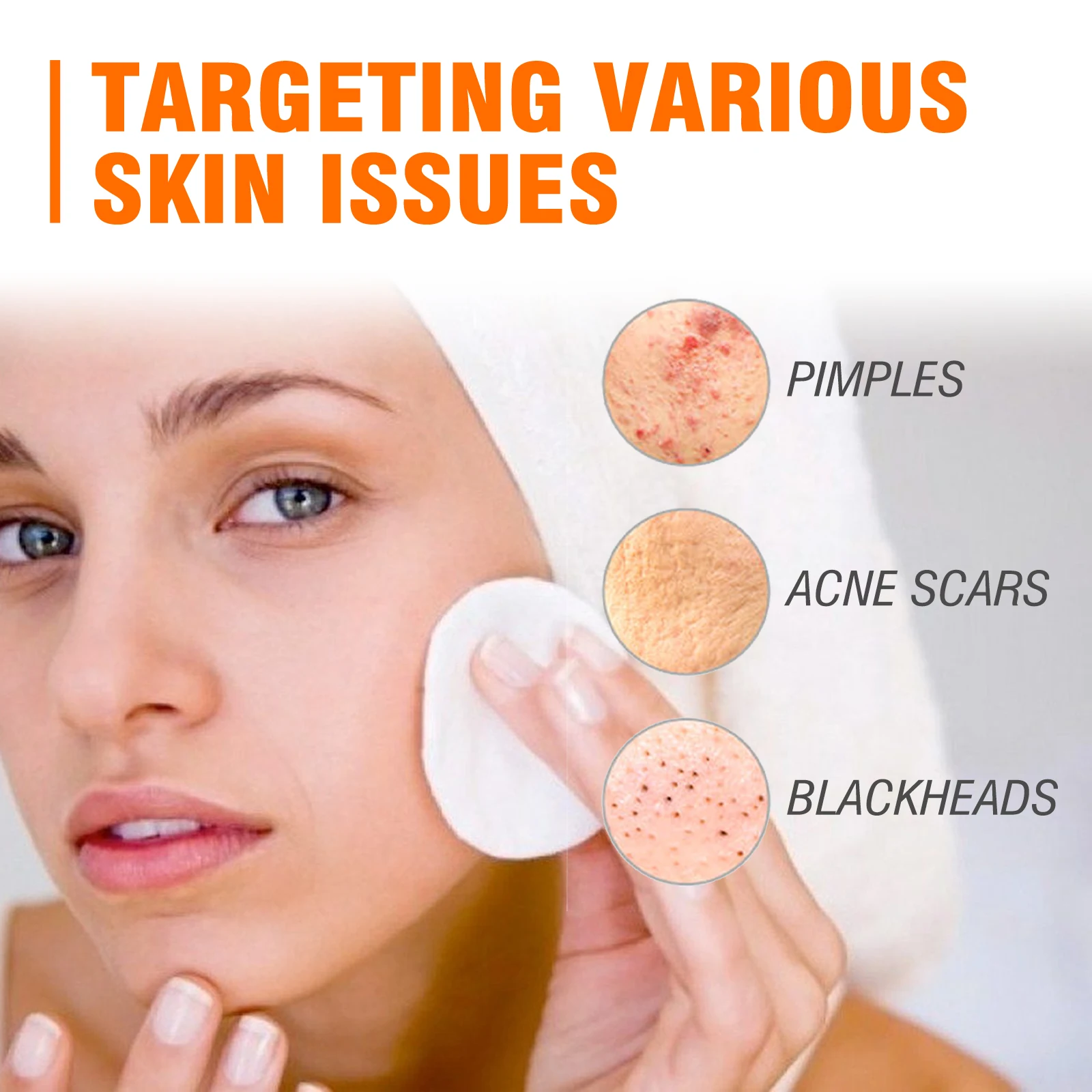 West Month Salicylic Acid Face Cream Moisturizing Acne Treatment Improve Roughness Pore Shink Remove Acne Scars Face Cream