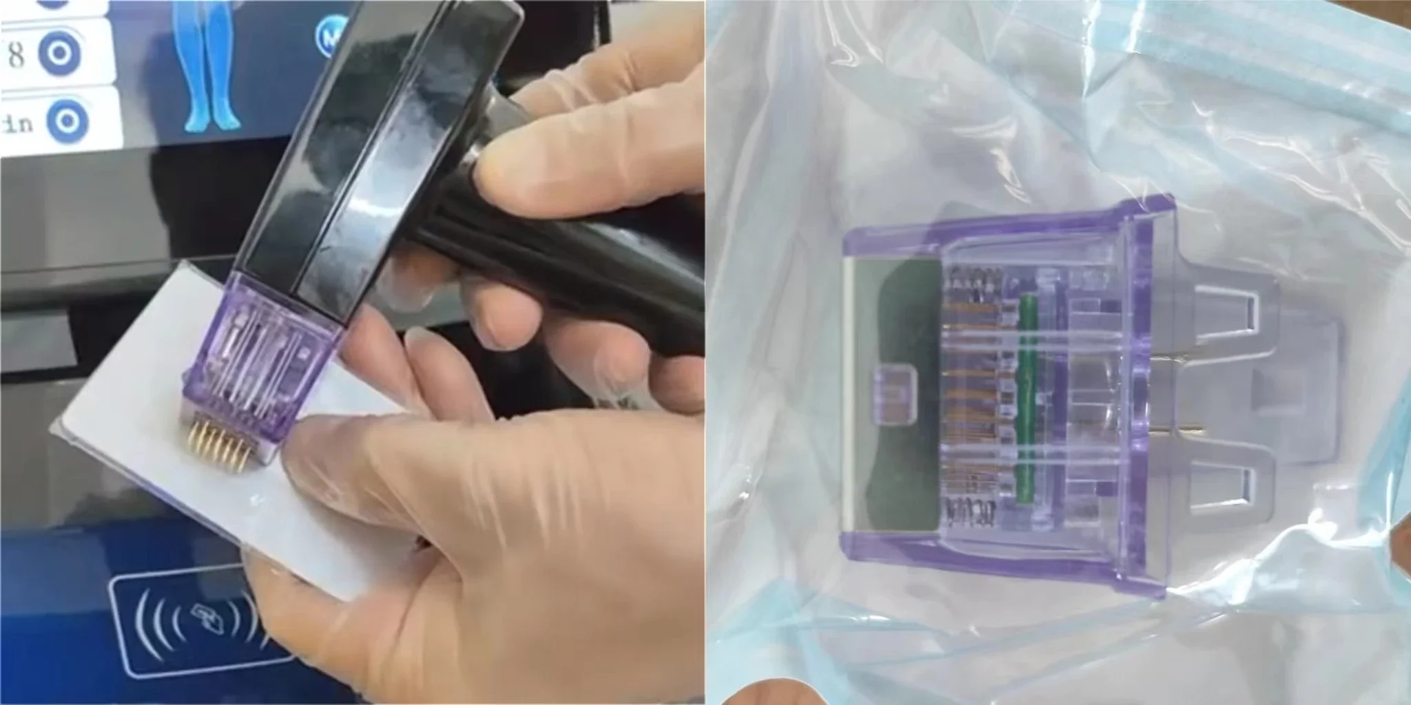 Description Picture 4 of item3 in 1 Remove wrinkles machine skin care With ice hammer