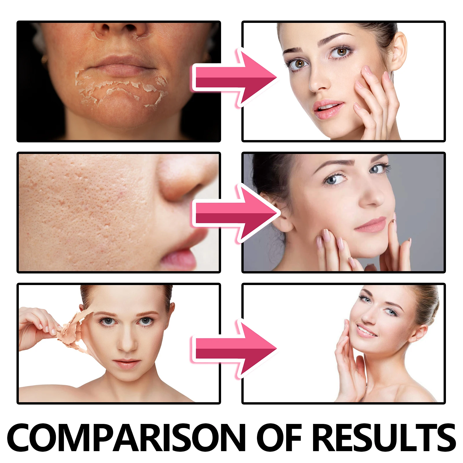 EELHOE Strawberry Face Scurb Gentle Remove Dead Skin Improve Roughness Moisturizing Smoothing Facial Exfoliating Gel