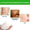 Facial Wash Cleanser Deep Cleansing Oil Control Moisturizing Remove Blackheads Shrink Pores A-cne Treatment Face Wash Foam 100g 5