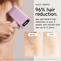 MLAY T14 épilateur laser malais épilation originale IPL Machine permanente dispositif d'épilation pour visage corps femme épilateur à domicile 3